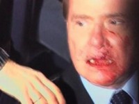 Сильвио Берлускони в кровь разбили лицо (ФОТО)