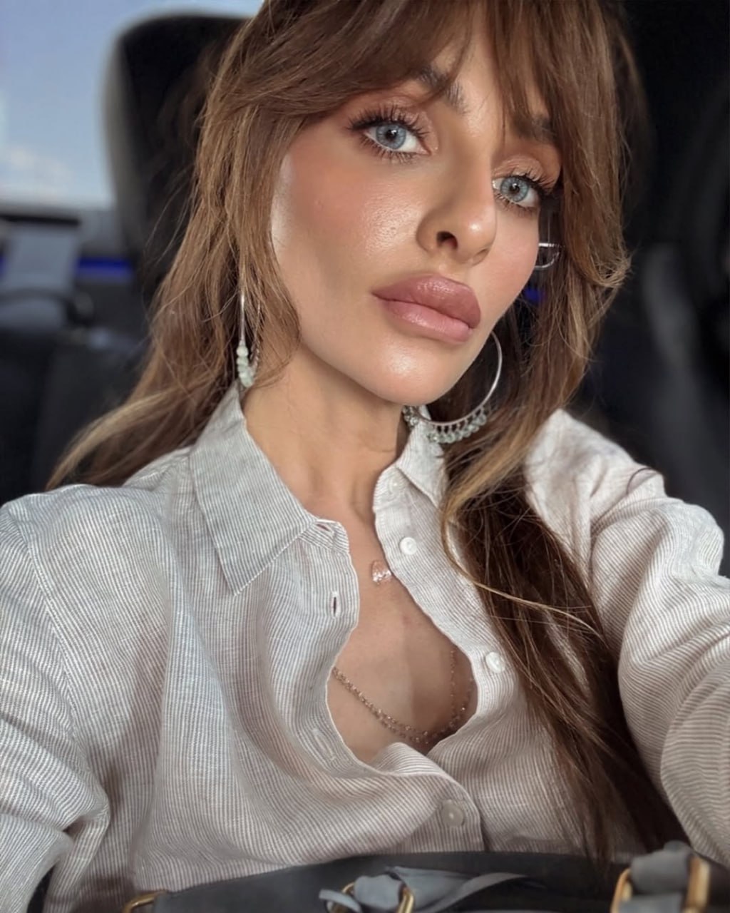 Екатерина Варнава увеличила губы
